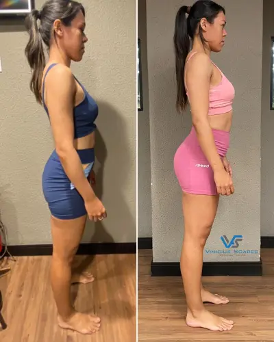 Antes e depois de aluna após um ano de treino