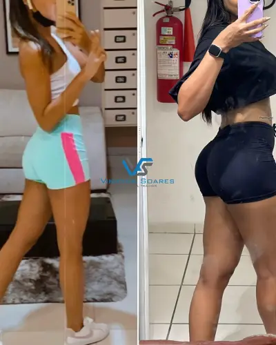 Antes e depois de aluna com evolução de postura e glúteo